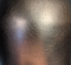 Applique*Entrelacs Applique murale, Martel 300, Travertin, Bronze marron foncé patiné, IP44, LED, dim, 2700K, 700 lm, L15cm, H30cm - Travertin, Bronze patiné marron foncé