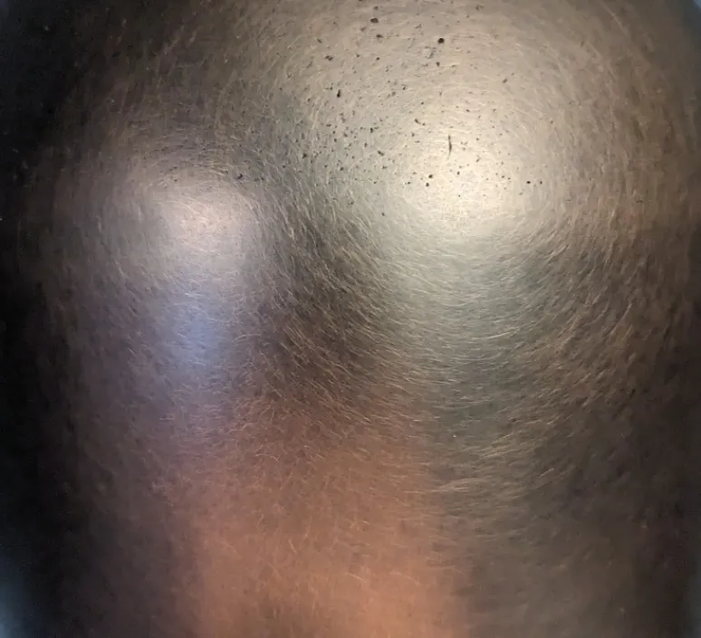 Applique*Entrelacs Applique murale, Martel 300, Travertin, Bronze marron foncé patiné, IP44, LED, dim, 2700K, 700 lm, L15cm, H30cm - Travertin, Bronze patiné marron foncé